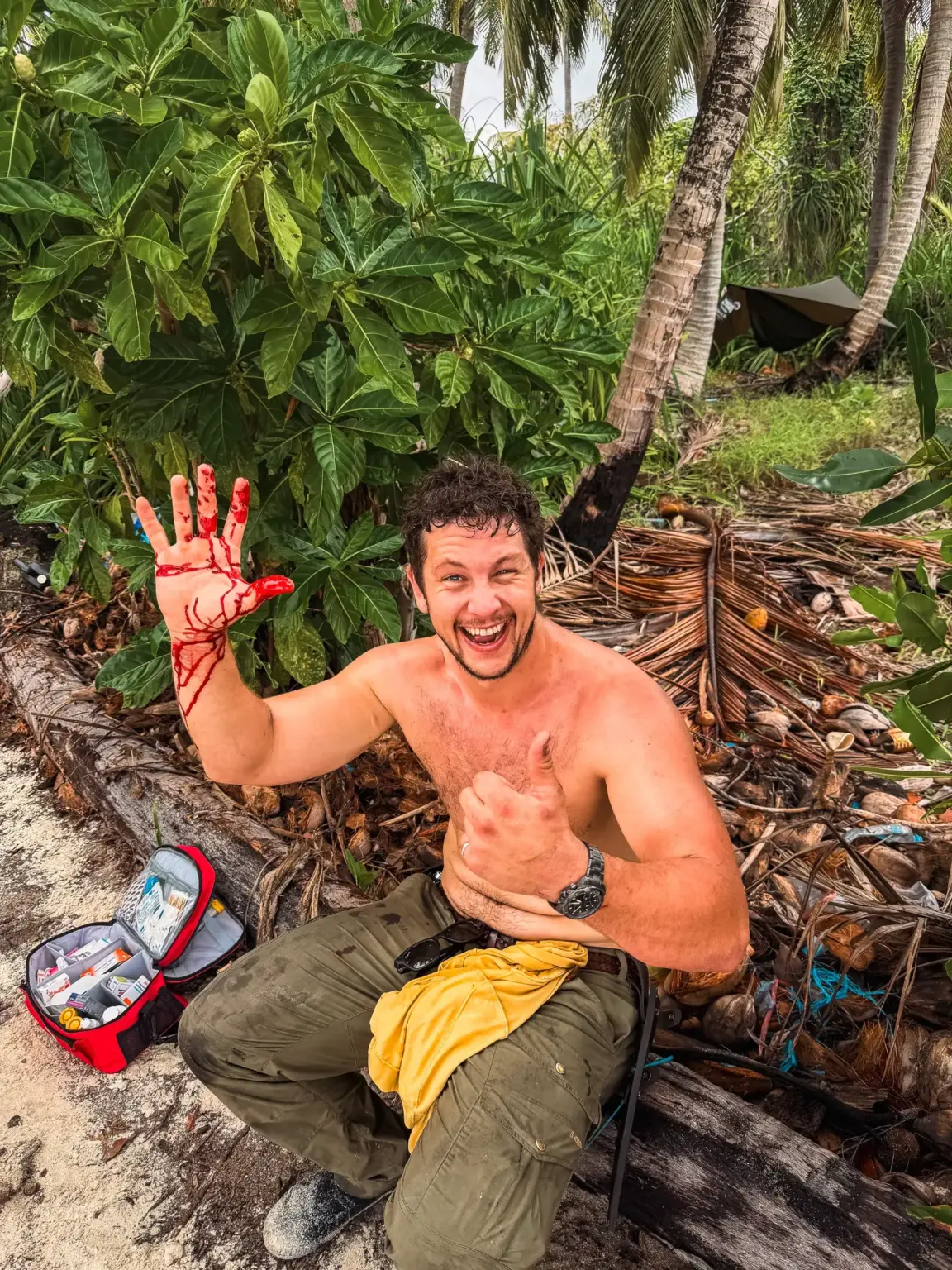 Man with bloody hand gives thumbs up near first aid kit on beach.